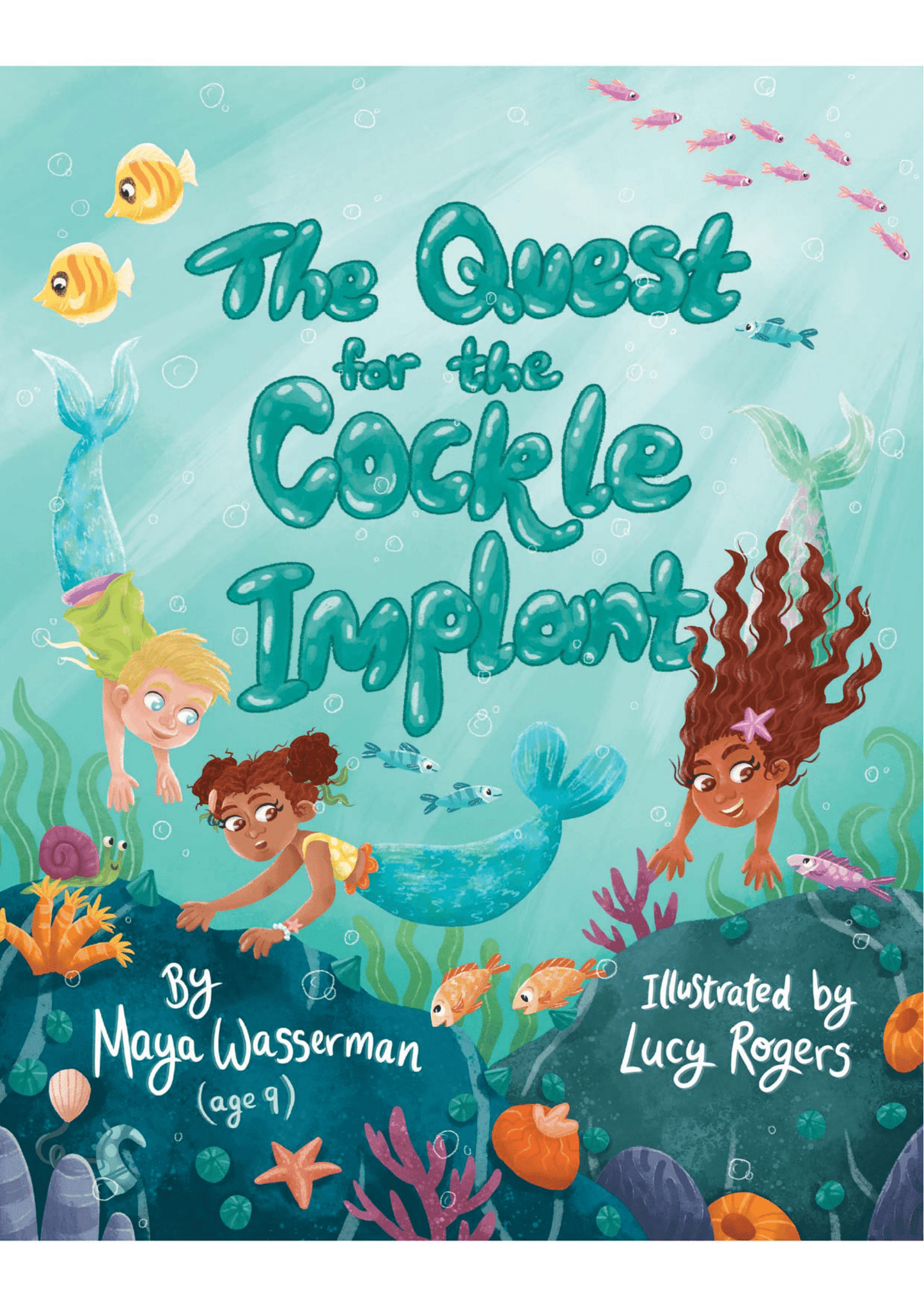 The Quest for the Cockle Implant